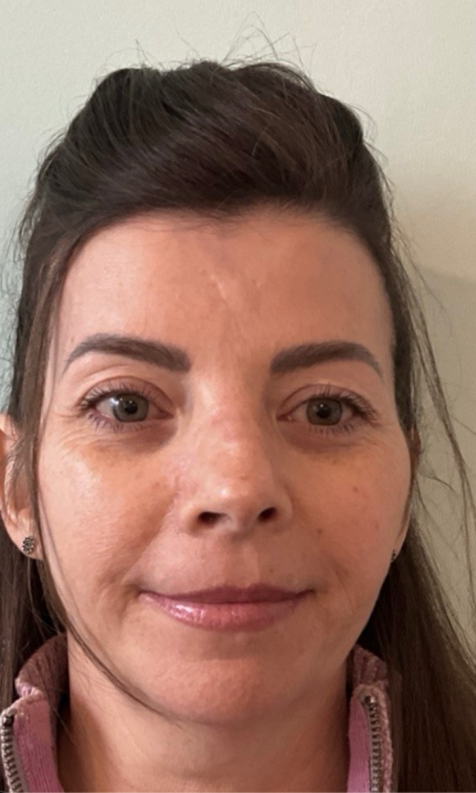 Before treatment