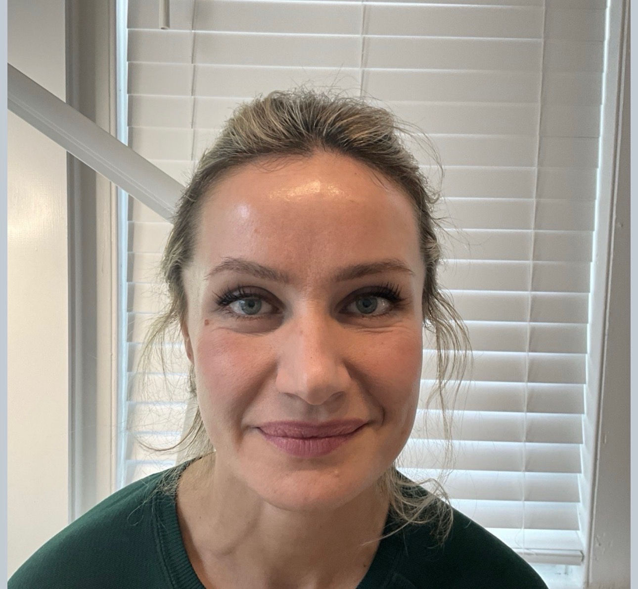 Before treatment