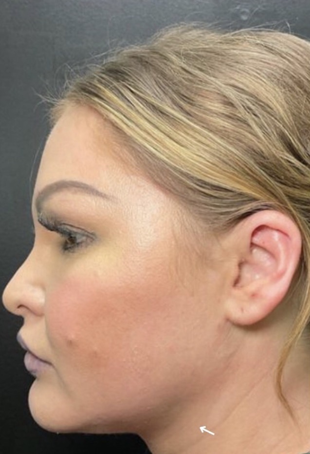 Before treatment
