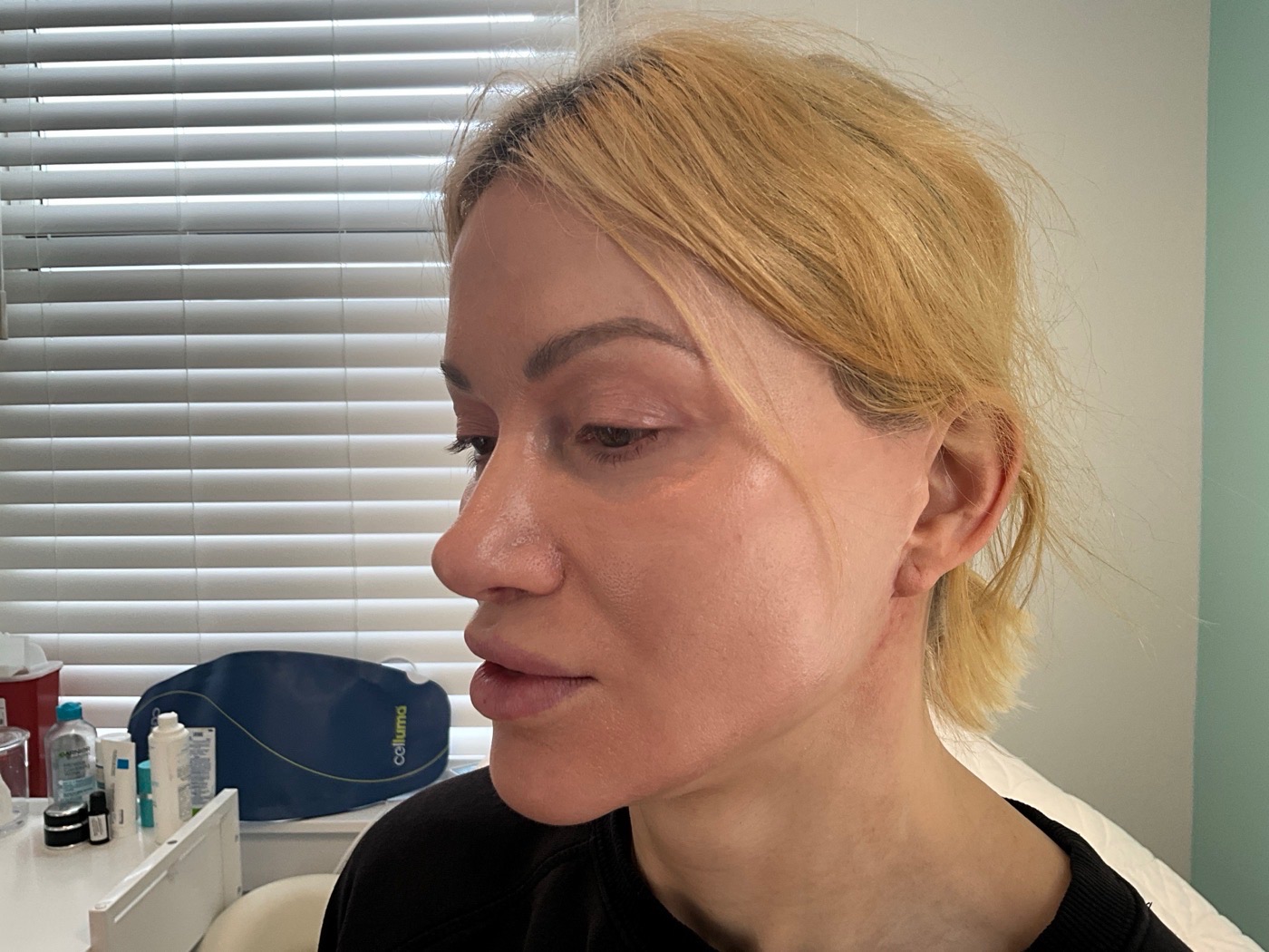 After treatment